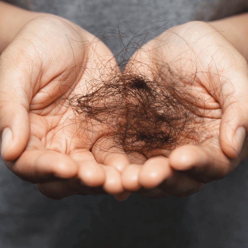When Does Postpartum Hair Loss Start