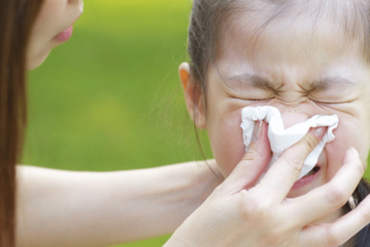 Nose Bleed in Children