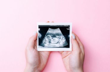 pregnant woman ultrasound down syndrome diagnosis singapore