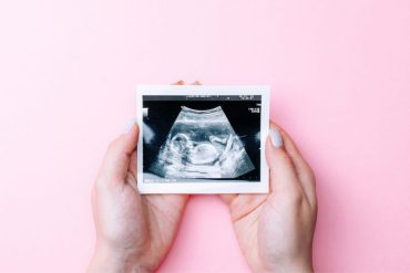 pregnant woman ultrasound down syndrome diagnosis singapore