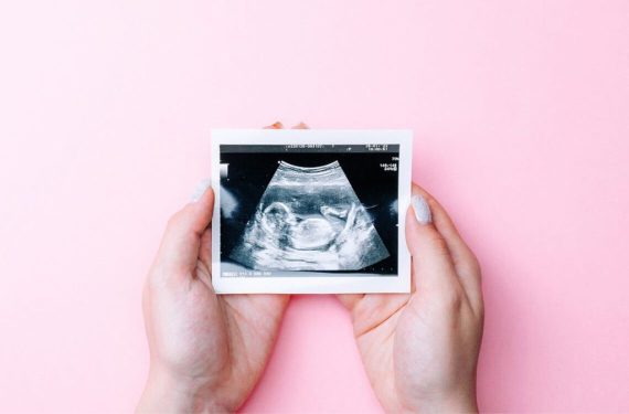 pregnant woman ultrasound down syndrome diagnosis singapore